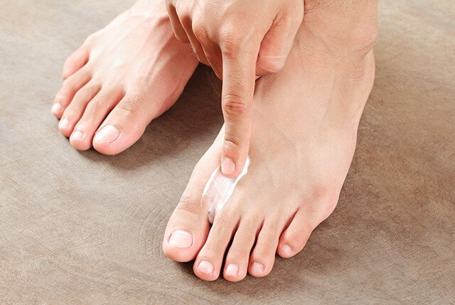 足に薬を塗る男性